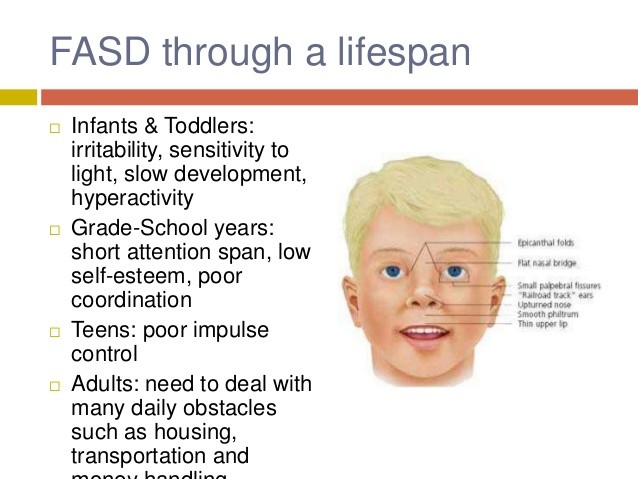 How long do adults with down syndrome live