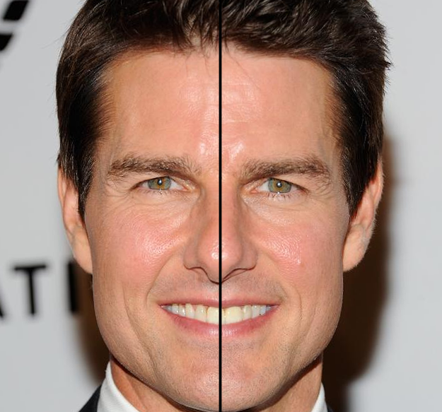 tom cruise tooth off center
